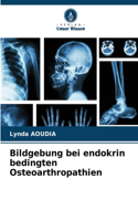 Bildgebung bei endokrin bedingten Osteoarthropathien