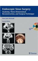 Endoscopic Sinus Surgery: Anatomy, Three-dimensional Reconstruction, and Surgical Technique