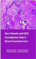 How Vimentin and CD34 Investigations help in Breast Carcinoma Care