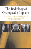 The Radiology of Orthopaedic Implants: An Atlas of Techniques and Assessment Hardcover â€“ 9 May 2001