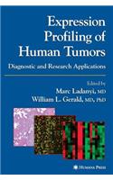 Expression Profiling of Human Tumors