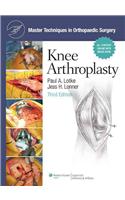 Knee Arthroplasty [With Access Code]
