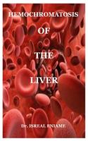 hemochromatosis of the liver