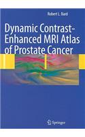 Dynamic Contrast-Enhanced MRI Atlas of Prostate Cancer