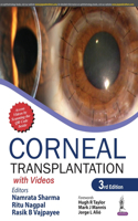 Corneal Transplantation