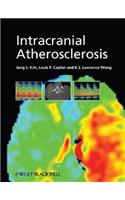Intracranial Atherosclerosis