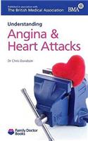 Understanding Angina & Heart Attacks