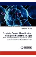 Prostate Cancer Classification using Multispectral Images