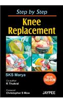 Step by Step Knee Replacement