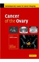 Cancer of the Ovary