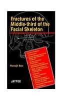 Fractures of the Middle-third of the Facial Skelton