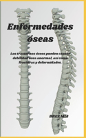 Enfermedades óseas
