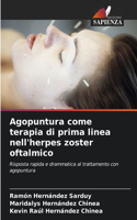 Agopuntura come terapia di prima linea nell'herpes zoster oftalmico
