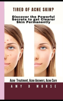 TIRED OF ACNE SKIN? Discover the Powerful Secrets to get clearer skin Permanently: (1 Volume)