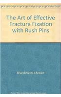The Art of Effective Fracture Fixation with Rush Pins