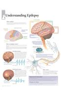 Understanding Epilepsy Paper Poster