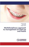 Multidisciplinary approach to management of Cleft Lip and Palate