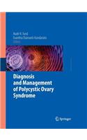 Diagnosis and Management of Polycystic Ovary Syndrome