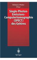 Single-Photon-Emissions-Computertomographie (Spect) Des Gehirns