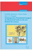 Contemporary Periodontal Surgery