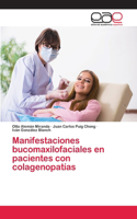 Manifestaciones bucomaxilofaciales en pacientes con colagenopatías