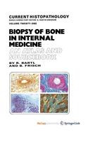 Biopsy of Bone in Internal Medicine