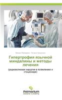 Gipertrofiya Yazychnoy Mindaliny I Metody Lecheniya