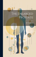 Enlarged Prostate