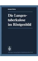 Die Lungentuberkulose Im Rontgenbild