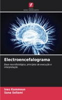 Electroencefalograma