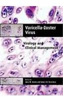 Varicella-Zoster Virus