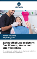 Zahnaufhellung meistern