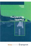 Fractures of the Tibial Pilon