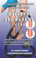 The Ultimate guide for Varicose veins