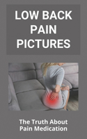 Low Back Pain Pictures