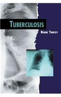 Tuberculosis