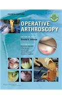 Operative Arthroscopy