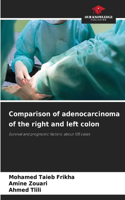 Comparison of adenocarcinoma of the right and left colon