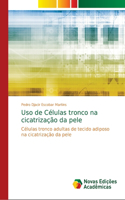 Uso de Células tronco na cicatrização da pele