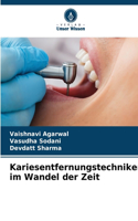 Kariesentfernungstechniken im Wandel der Zeit