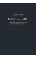 Hand Und Arm