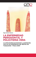 Enfermedad Periodontal Y Policitemia Vera