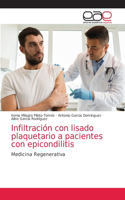 Infiltración con lisado plaquetario a pacientes con epicondilitis