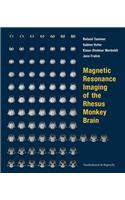 Magnetic Resonance Imaging of the Rhesus Monkey Brain