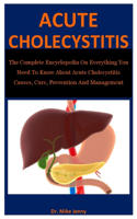 Acute Cholecystitis: The Complete Encyclopedia On Everything You Need To Know About Acute Cholecystitis Causes, Cure, Prevention And Management