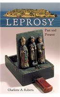 Leprosy