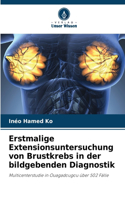 Erstmalige Extensionsuntersuchung von Brustkrebs in der bildgebenden Diagnostik
