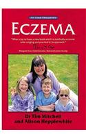 Eczema