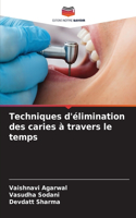 Techniques d'élimination des caries à travers le temps