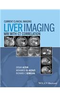 Liver Imaging